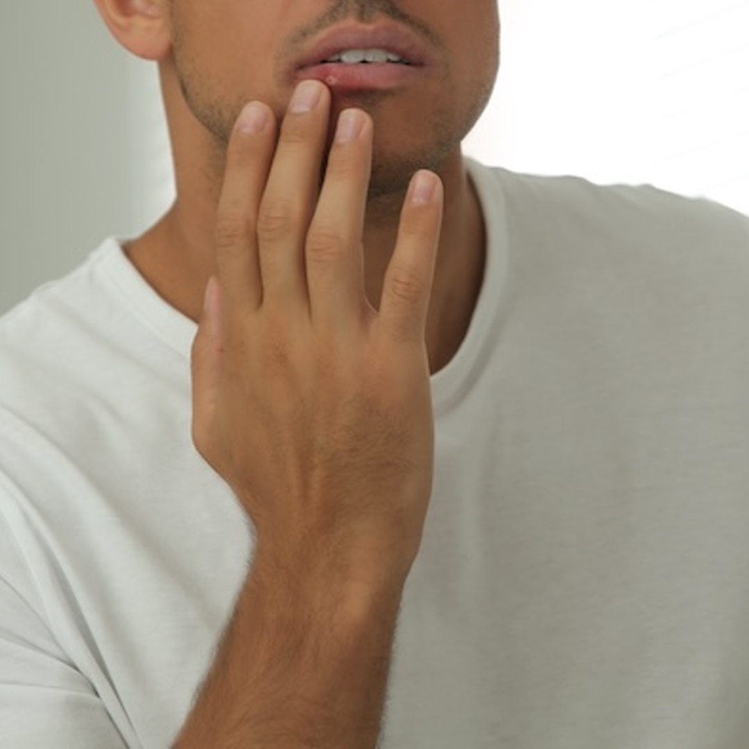 Dental Ulcer available in online  pharmacy qatar, doha 